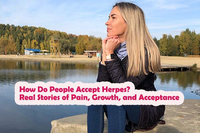 how do people accept herpes, accepting herpes diagnosis, herpes acceptance stories, living with herpes emotionally, herpes stigma acceptance