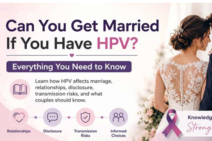 can you get married if you have HPV, HPV and marriage, getting married with HPV