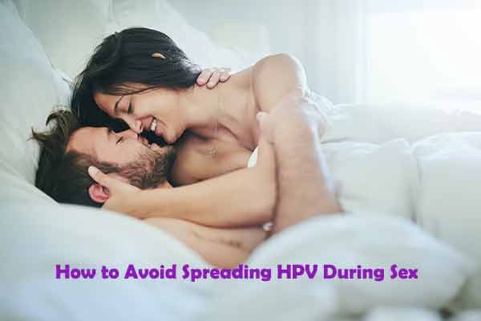 How to Avoid Spreading HPV During Sex