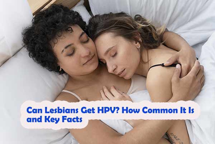 Can Lesbians Get HPV? How Common It Is and Key Facts