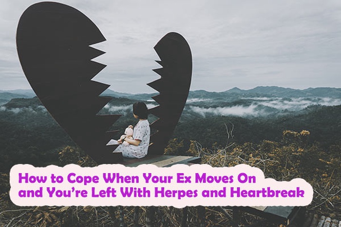 How to Cope When Your Ex Moves On and You&rsquo;re Left With Herpes and Heartbreak