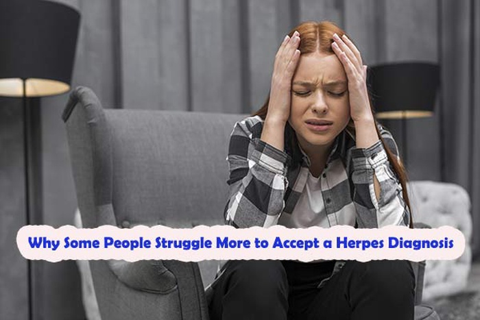 struggling emotionally to accept the diagnosis, coming to terms with herpes, how do I accept having herpes? how to fully accept a herpes diagnosis?