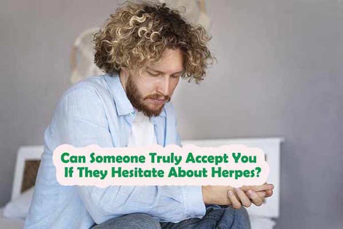 Can Someone Truly Accept You If They Hesitate About Herpes?