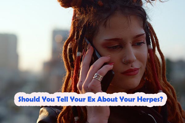 Should You Tell Your Ex About Your Herpes? A Complete Guide