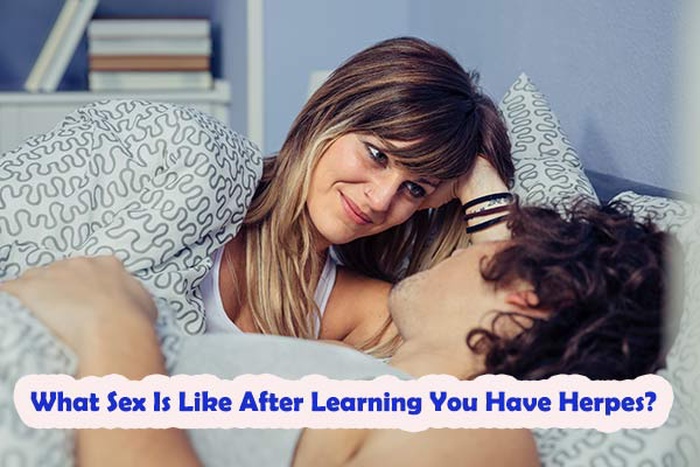 What Sex Is Like After Learning You Have Herpes, how people feel about sex after herpes