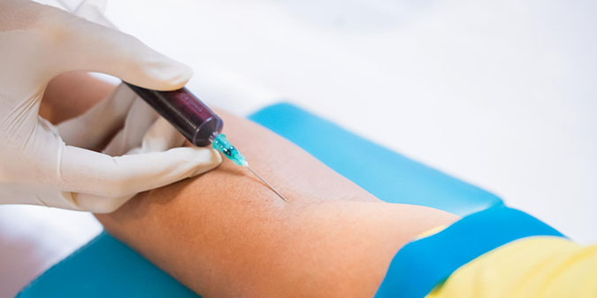 Can You Donate Plasma If You Have Herpes?