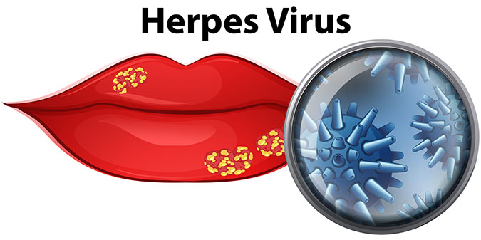 Types Infections and Spread