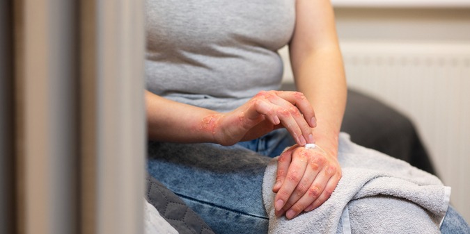 Can Herpes Go Away on Its Own? What HSV-Positive Singles Should Know