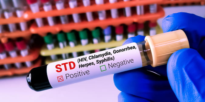 sti testing