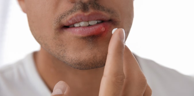 How Close Are We to Measuring and Curing Latent Herpes?