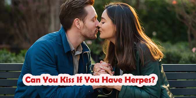 Can You Kiss If You Have Herpes? Risks, Safety & Dating Advice