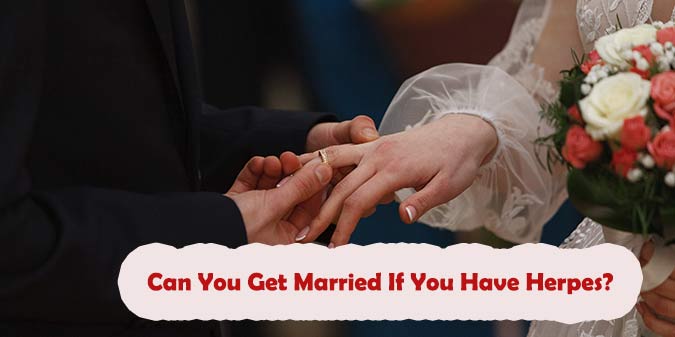 Can You Get Married If You Have Herpes? Tips & Relationship Advice, Full Guide