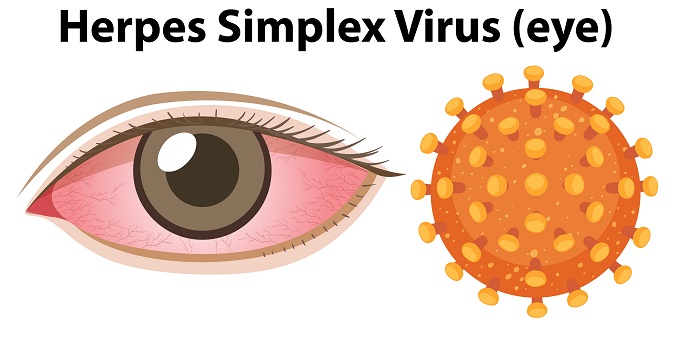herpes under eye