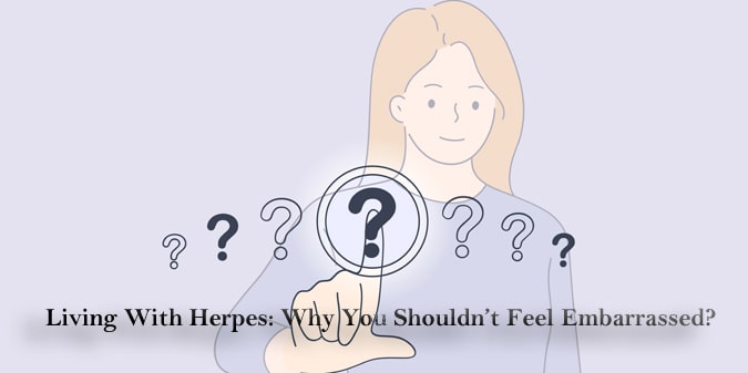 shouldn’t feel embarrassed if having herpes