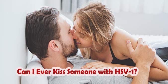 Can I Ever Kiss Someone with HSV-1